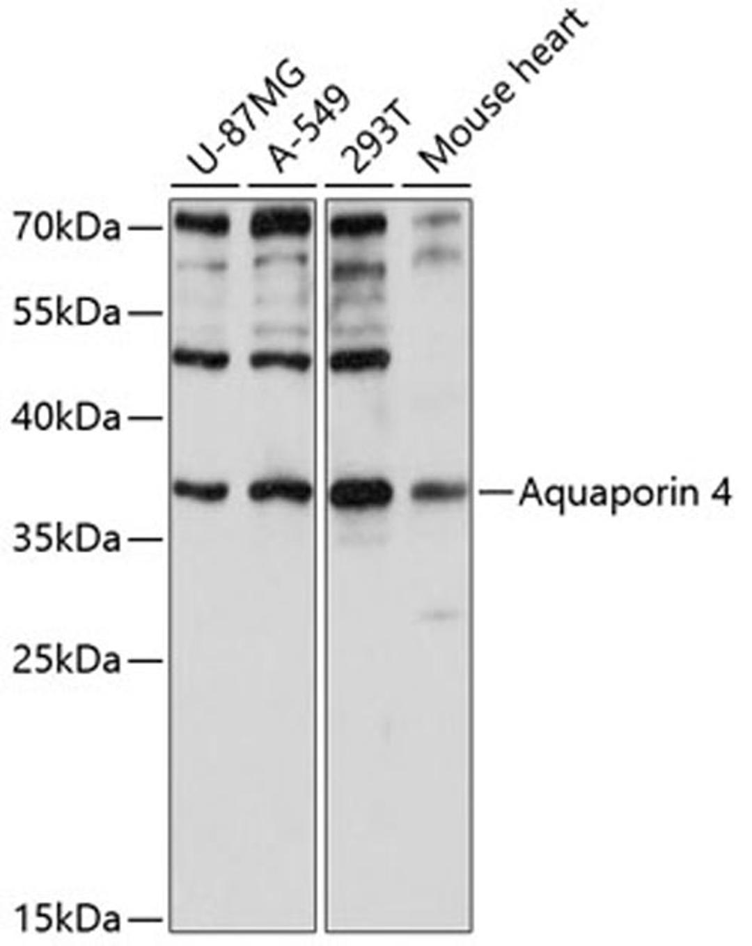 Western blot - Aquaporin 4 antibody (A2887)