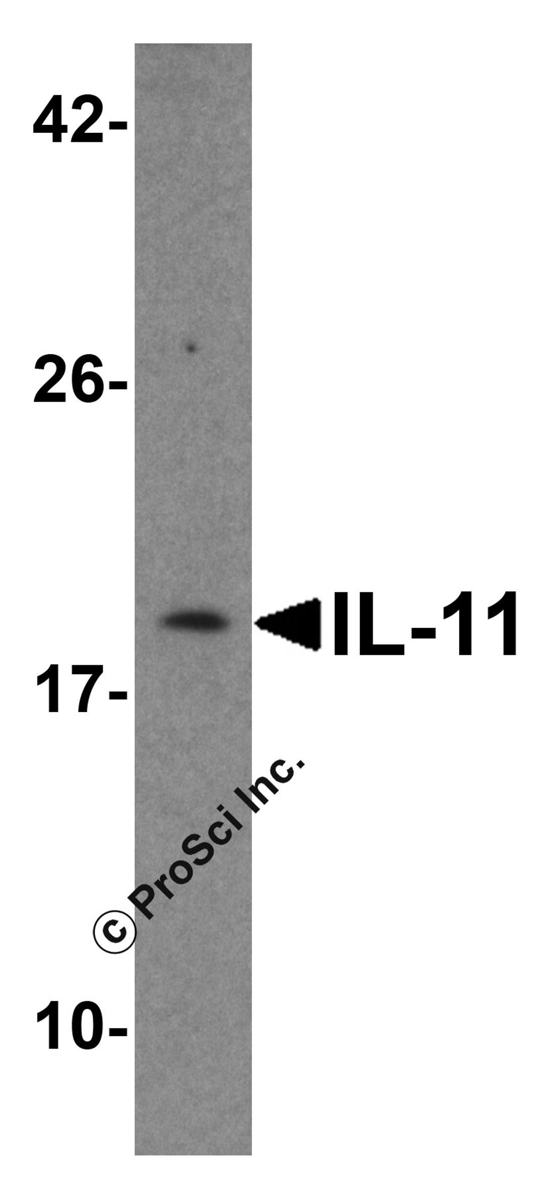 Western blot analysis of IL-11 in Hela Cell lysate with IL-11 antibody at 1 &#956;g/ml.