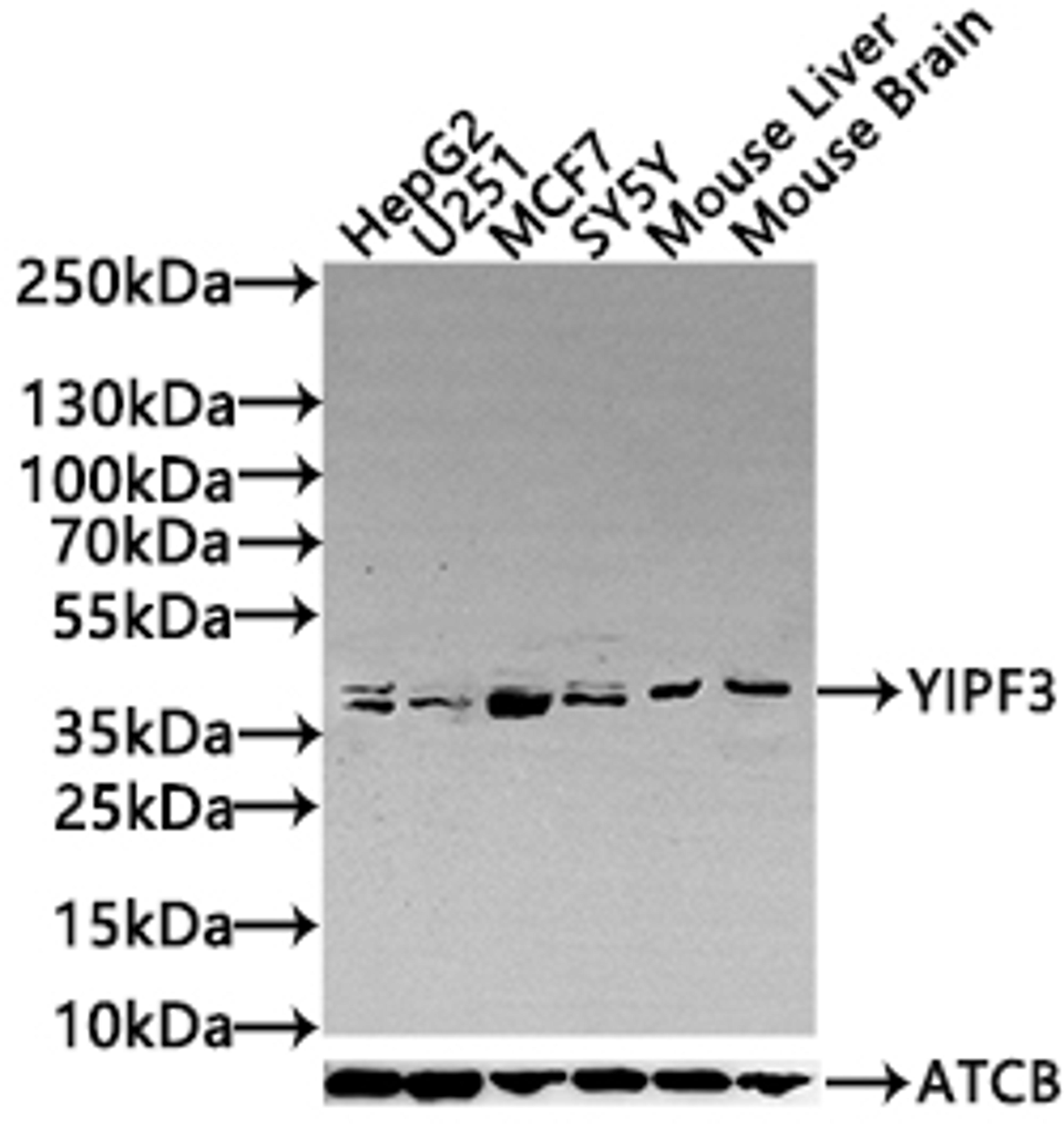 Western Blot. Positive WB detected in: Mouse heart tissue, Mouse liver tissue, Mouse brain tissue, Mouse stomach tissue. All lanes: YIPF3 antibody at 3ug/ml. Secondary. Goat polyclonal to rabbit IgG at 1/50000 dilution. Predicted band size: 39 kDa. Observed band size: 39 kDa.