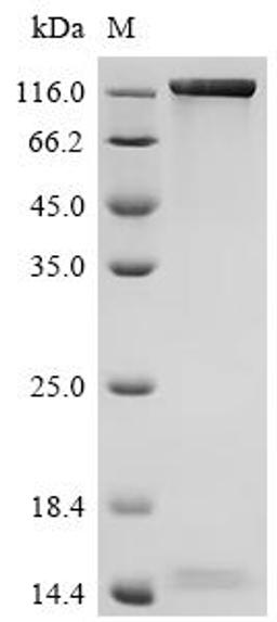 (Tris-Glycine gel) Discontinuous SDS-PAGE (reduced) with 5% enrichment gel and 15% separation gel.