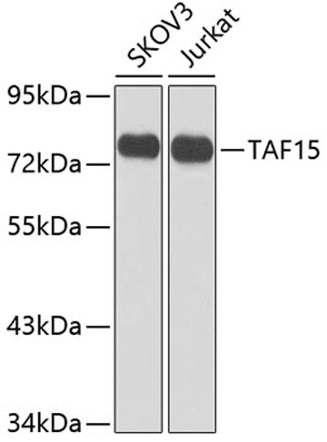 Western blot - TAF15 antibody (A8465)