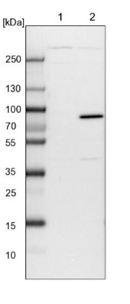 Western Blot: APEH Antibody [NBP1-85332] - Lane 1: NIH-3T3 cell lysate (Mouse embryonic fibroblast cells)<br/>Lane 2: NBT-II cell lysate (Rat Wistar bladder tumour cells)