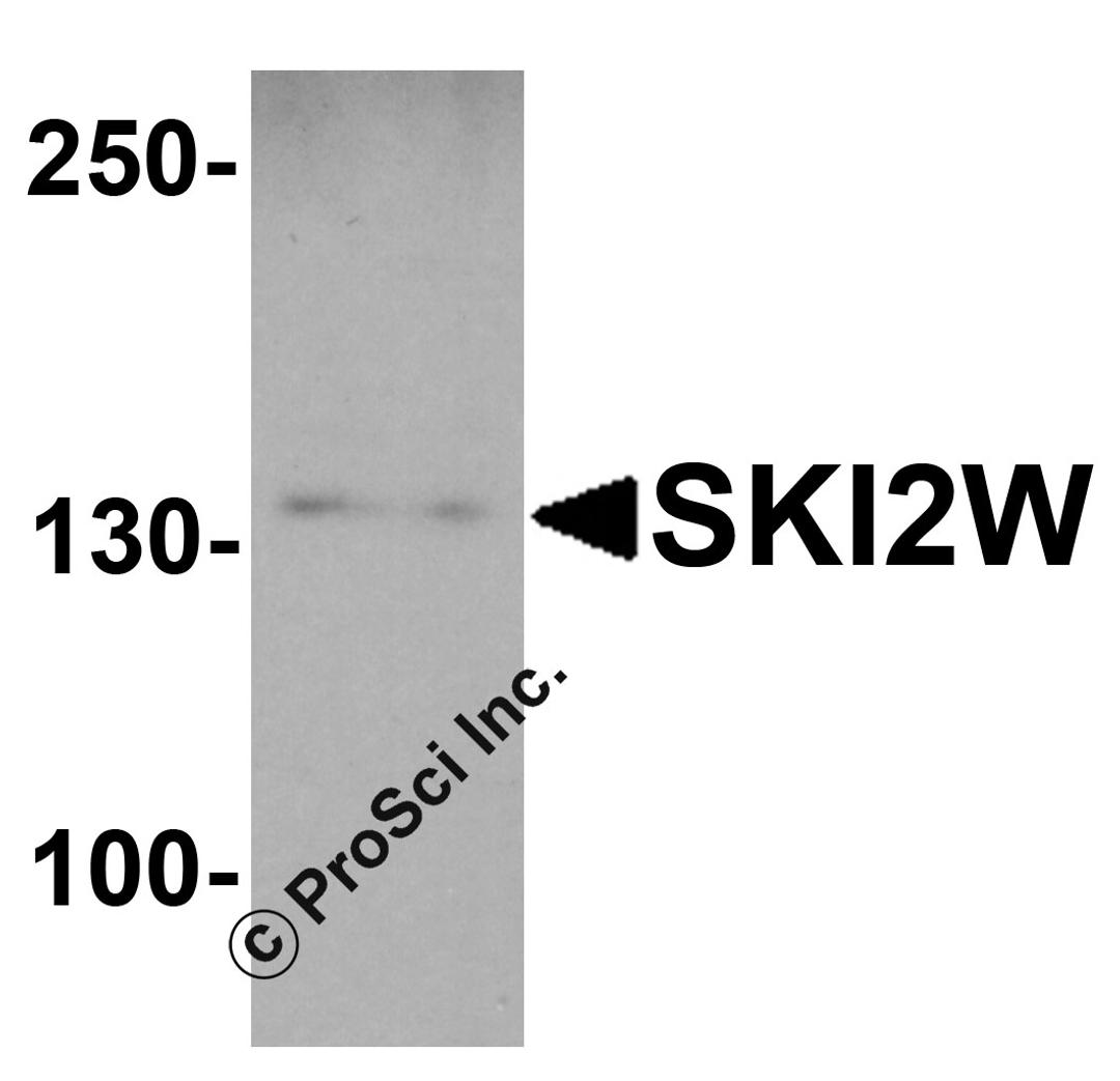 Western blot analysis of SKI2W in mouse stomach tissue lysate with SKI2W antibody at 1 &#956;g/ml.