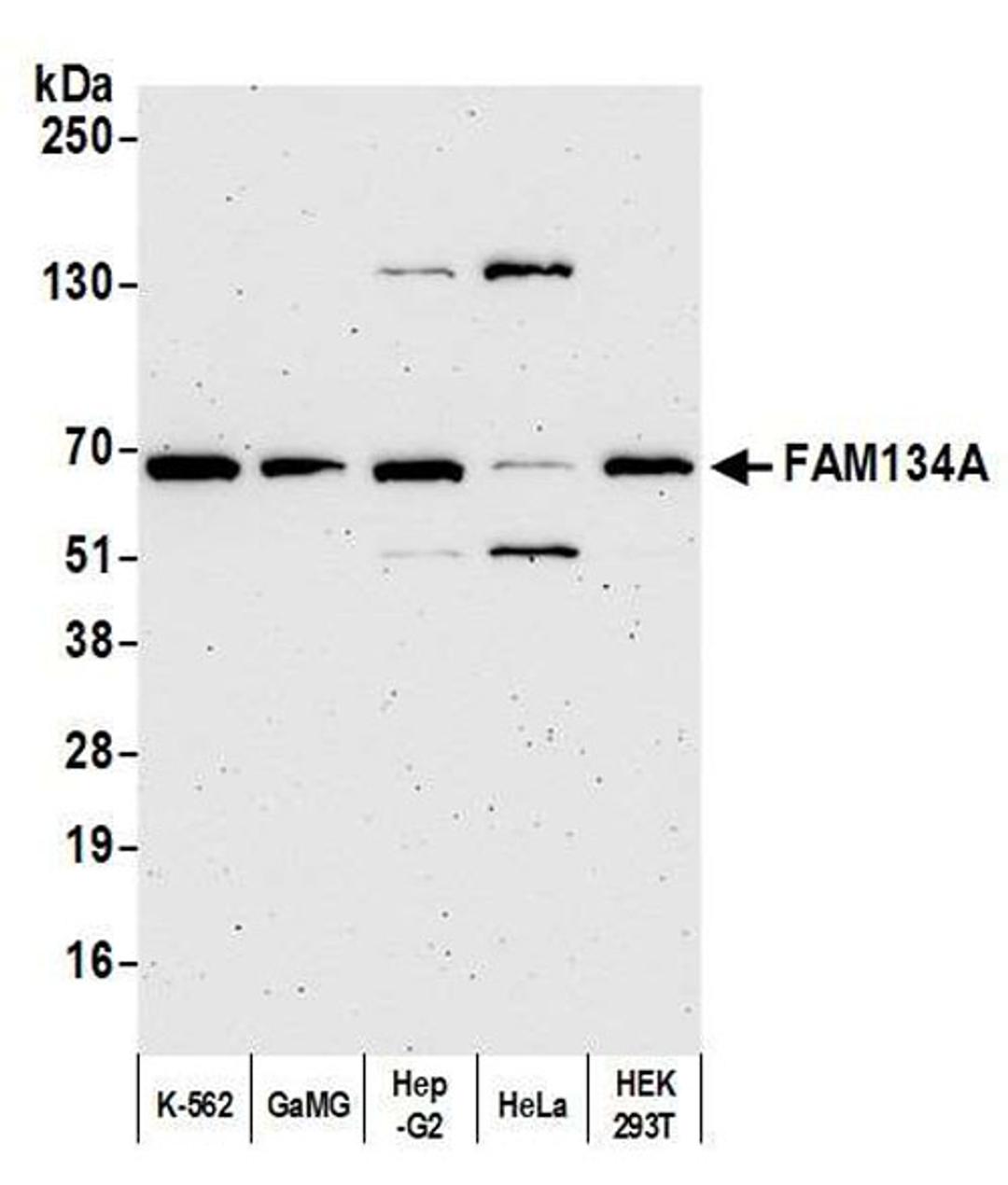 Detection of human FAM134A by WB.