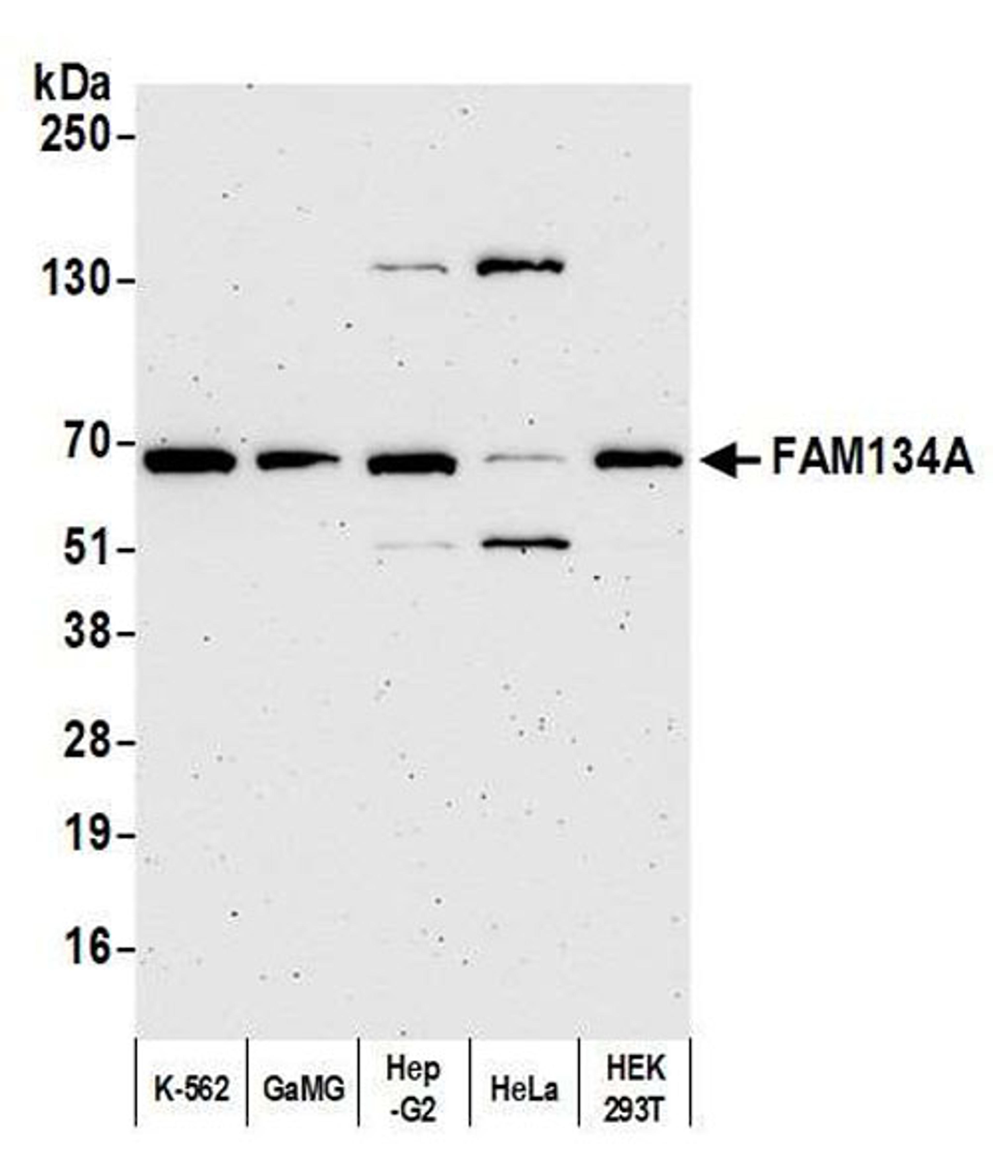 Detection of human FAM134A by WB.