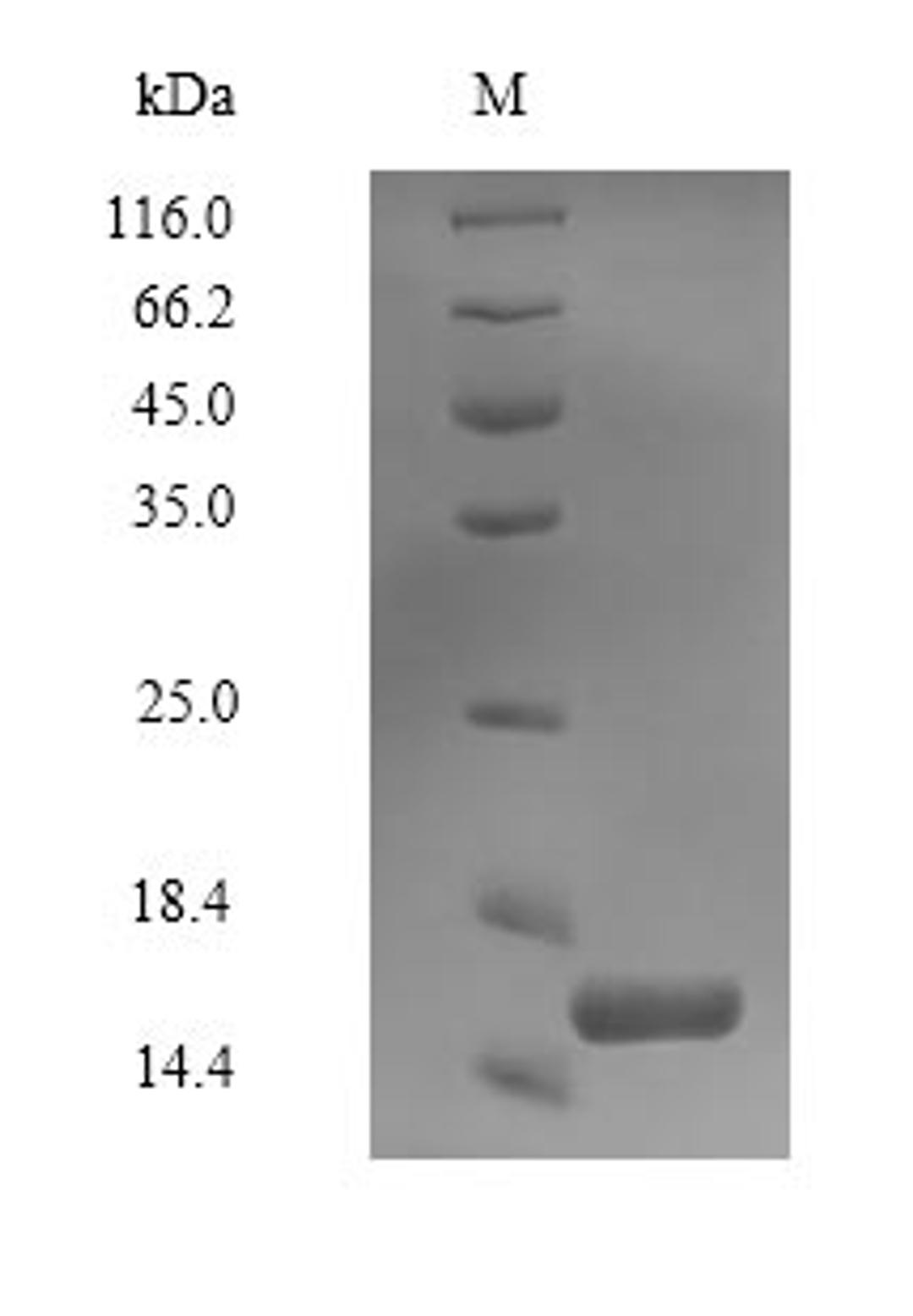 (Tris-Glycine gel) Discontinuous SDS-PAGE (reduced) with 5% enrichment gel and 15% separation gel.