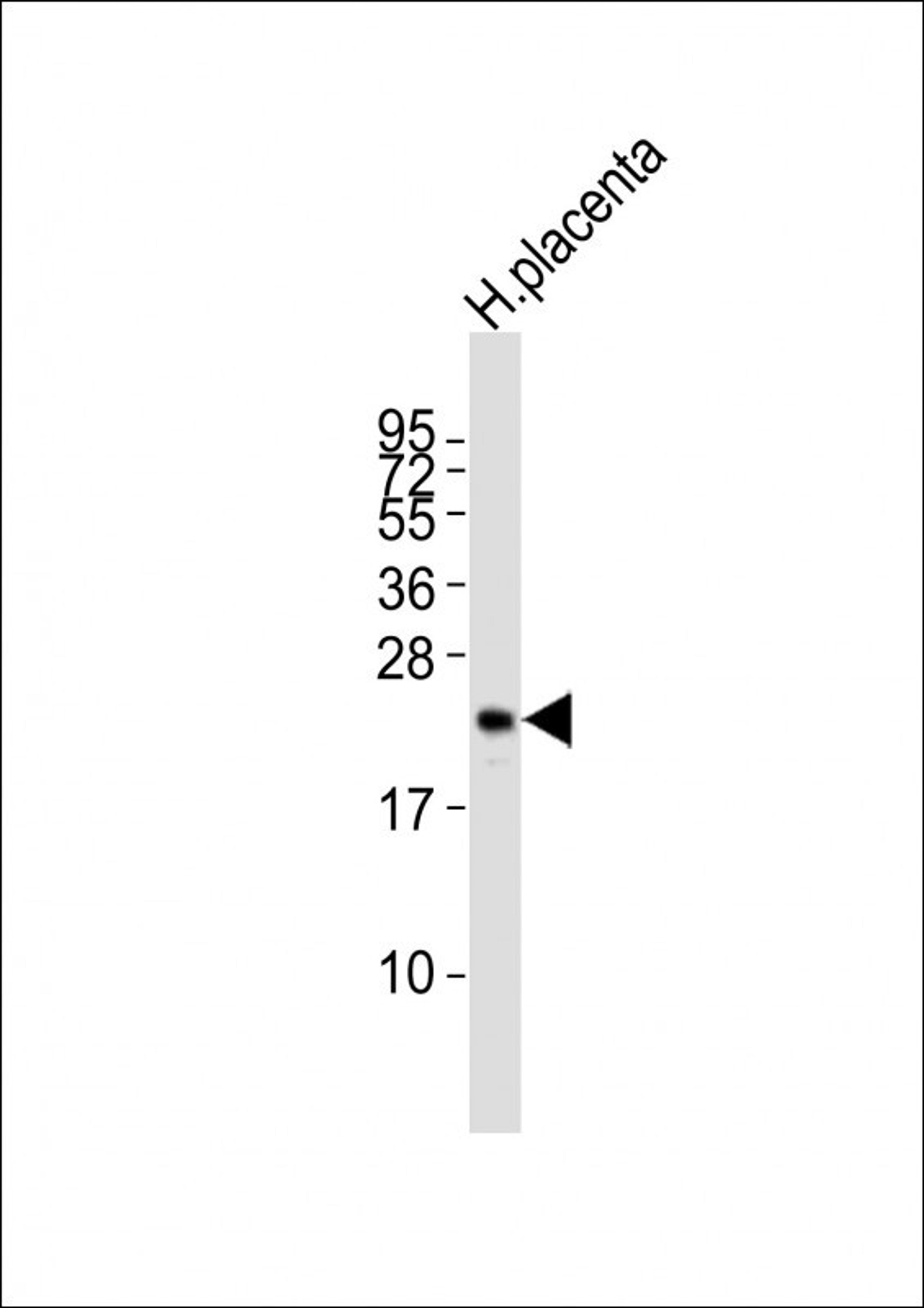 Western Blot at 1:2000 dilution + human placenta lysates Lysates/proteins at 20 ug per lane.