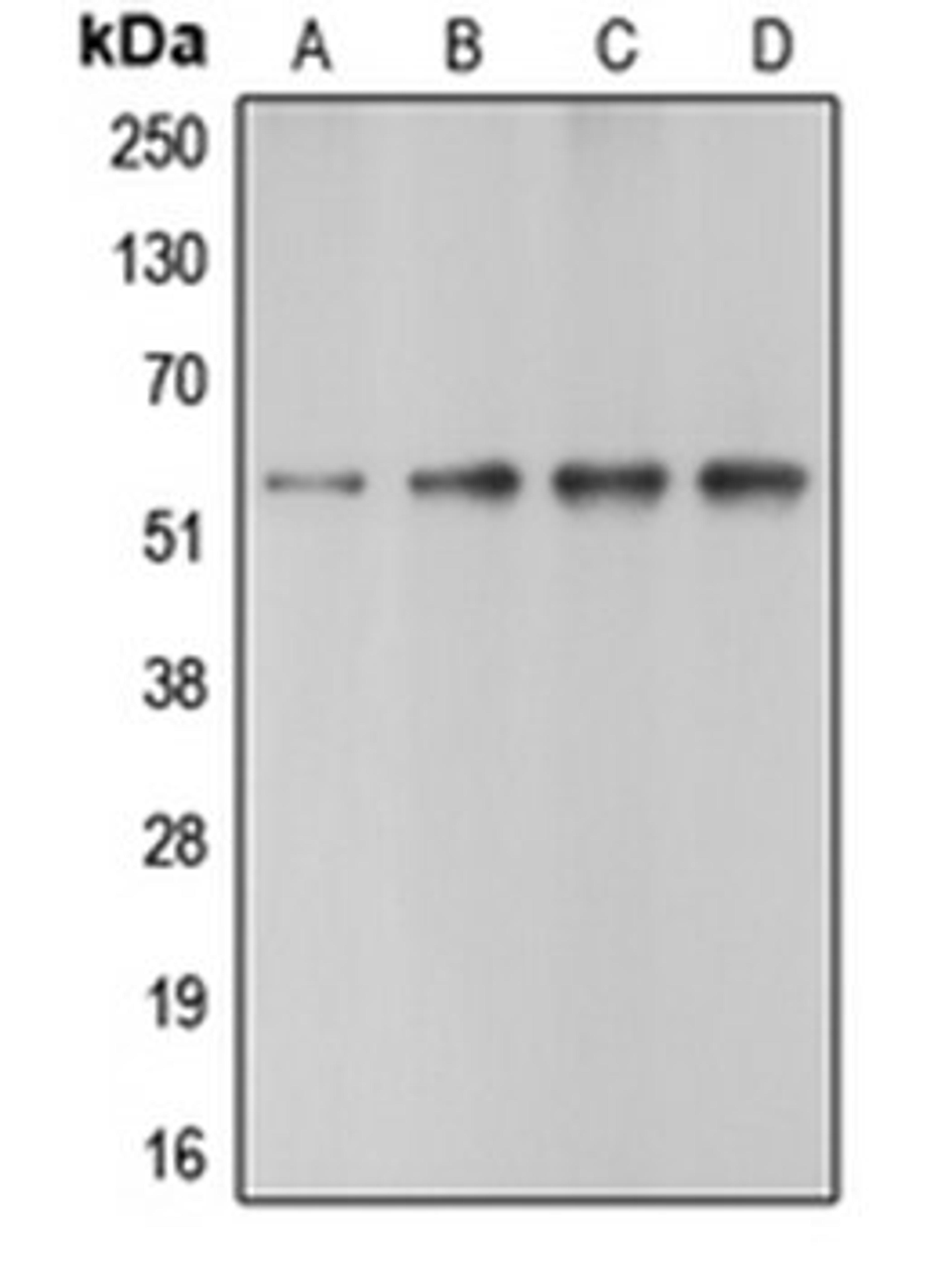 Western blot analysis of HeLa (Lane 1), Jurkat (Lane 2), mouse heart (Lane 3), rat heart (Lane 4) whole cell lysates using CASP10 antibody