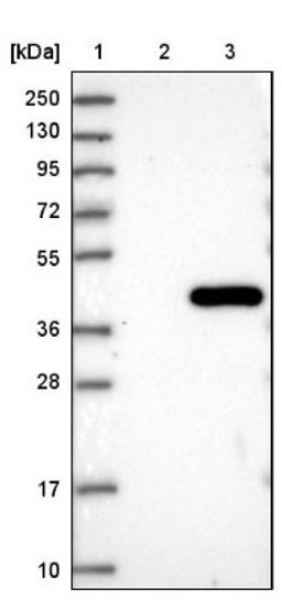 Western Blot: PPIL6 Antibody [NBP1-88766] - Lane 1: Marker [kDa] 250, 130, 95, 72, 55, 36, 28, 17, 10<br/>Lane 2: Negative control (vector only transfected HEK293T lysate)<br/>Lane 3: Over-expression lysate (Co-expressed with a C-terminal myc-DDK tag (~3.1 kDa) in mammalian HEK293T cells, LY406551)