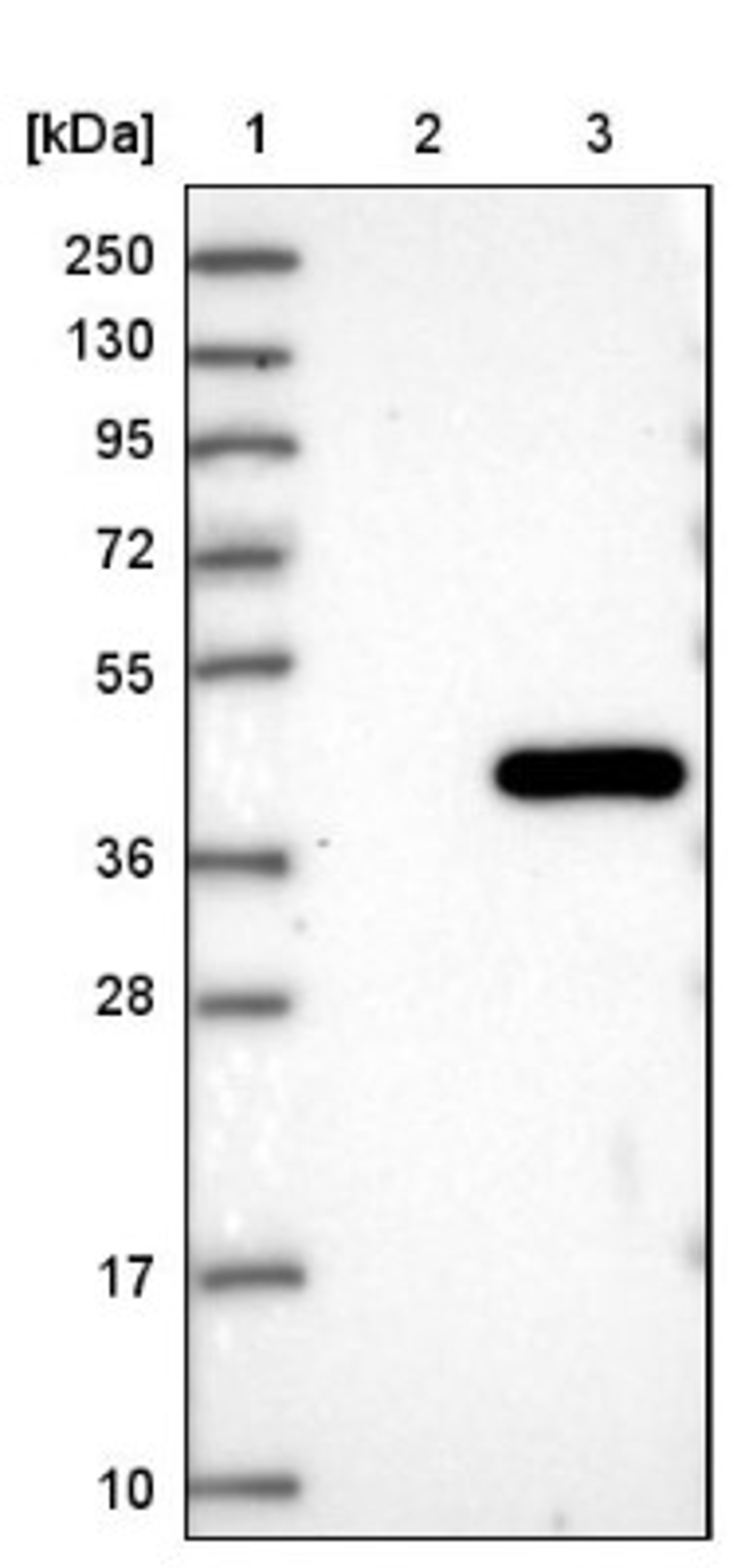 Western Blot: PPIL6 Antibody [NBP1-88766] - Lane 1: Marker [kDa] 250, 130, 95, 72, 55, 36, 28, 17, 10<br/>Lane 2: Negative control (vector only transfected HEK293T lysate)<br/>Lane 3: Over-expression lysate (Co-expressed with a C-terminal myc-DDK tag (~3.1 kDa) in mammalian HEK293T cells, LY406551)