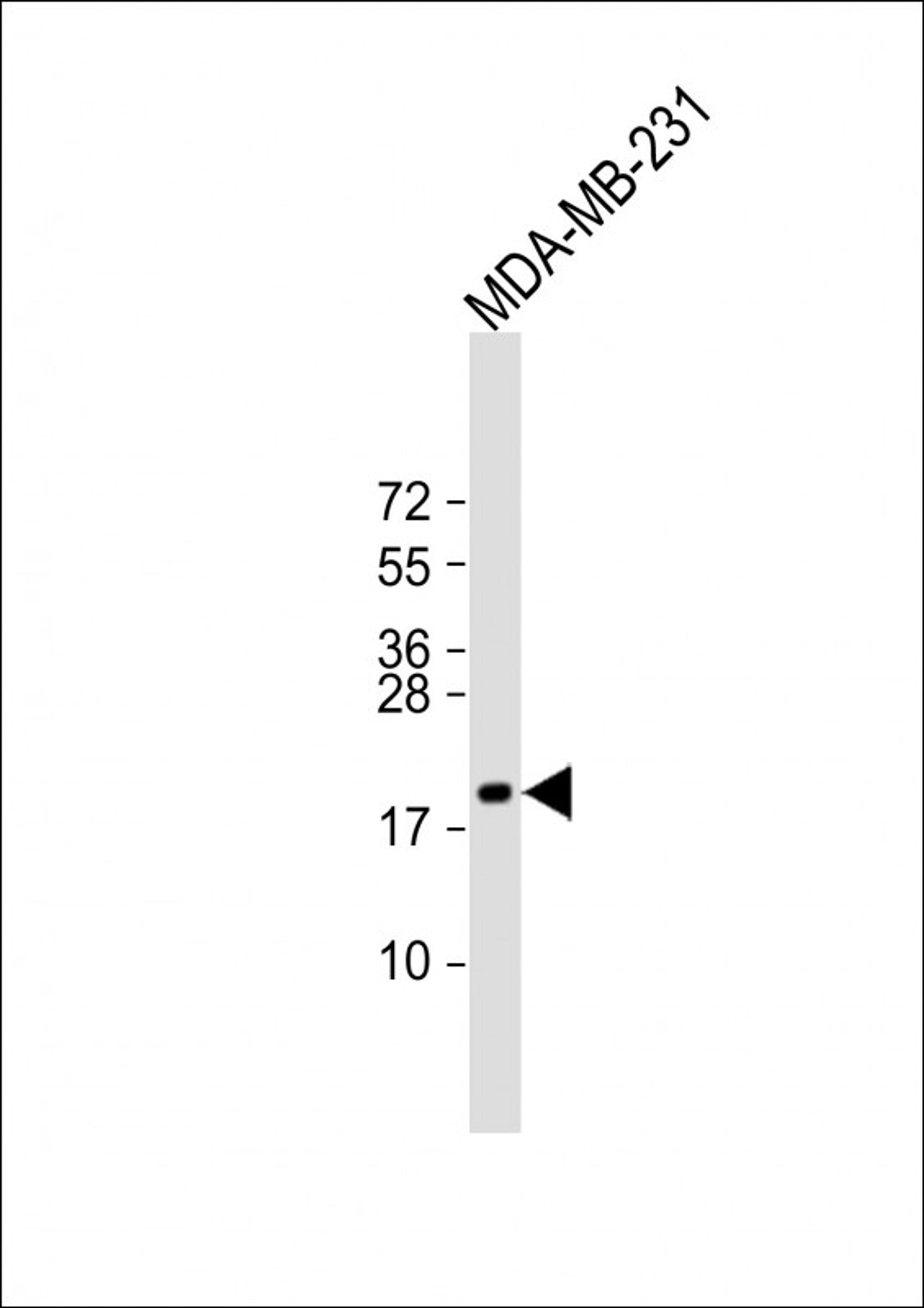 Western Blot at 1:1000 dilution + MDA-MB-231 whole cell lysate Lysates/proteins at 20 ug per lane.