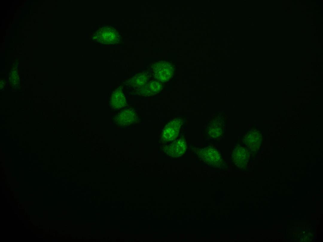 Immunofluorescence staining of Hela cell with CSB-RA914307A0HU at 1:50, counter-stained with DAPI. The cells were fixed in 4% formaldehyde and blocked in 10% normal Goat Serum. The cells were then incubated with the antibody overnight at 4°C. The secondary antibody was Alexa Fluor 591-congugated AffiniPure Goat Anti-Rabbit IgG(H+L).