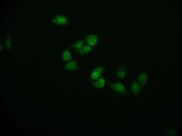 Immunofluorescence staining of Hela cell with CSB-RA914307A0HU at 1:50, counter-stained with DAPI. The cells were fixed in 4% formaldehyde and blocked in 10% normal Goat Serum. The cells were then incubated with the antibody overnight at 4°C. The secondary antibody was Alexa Fluor 591-congugated AffiniPure Goat Anti-Rabbit IgG(H+L).