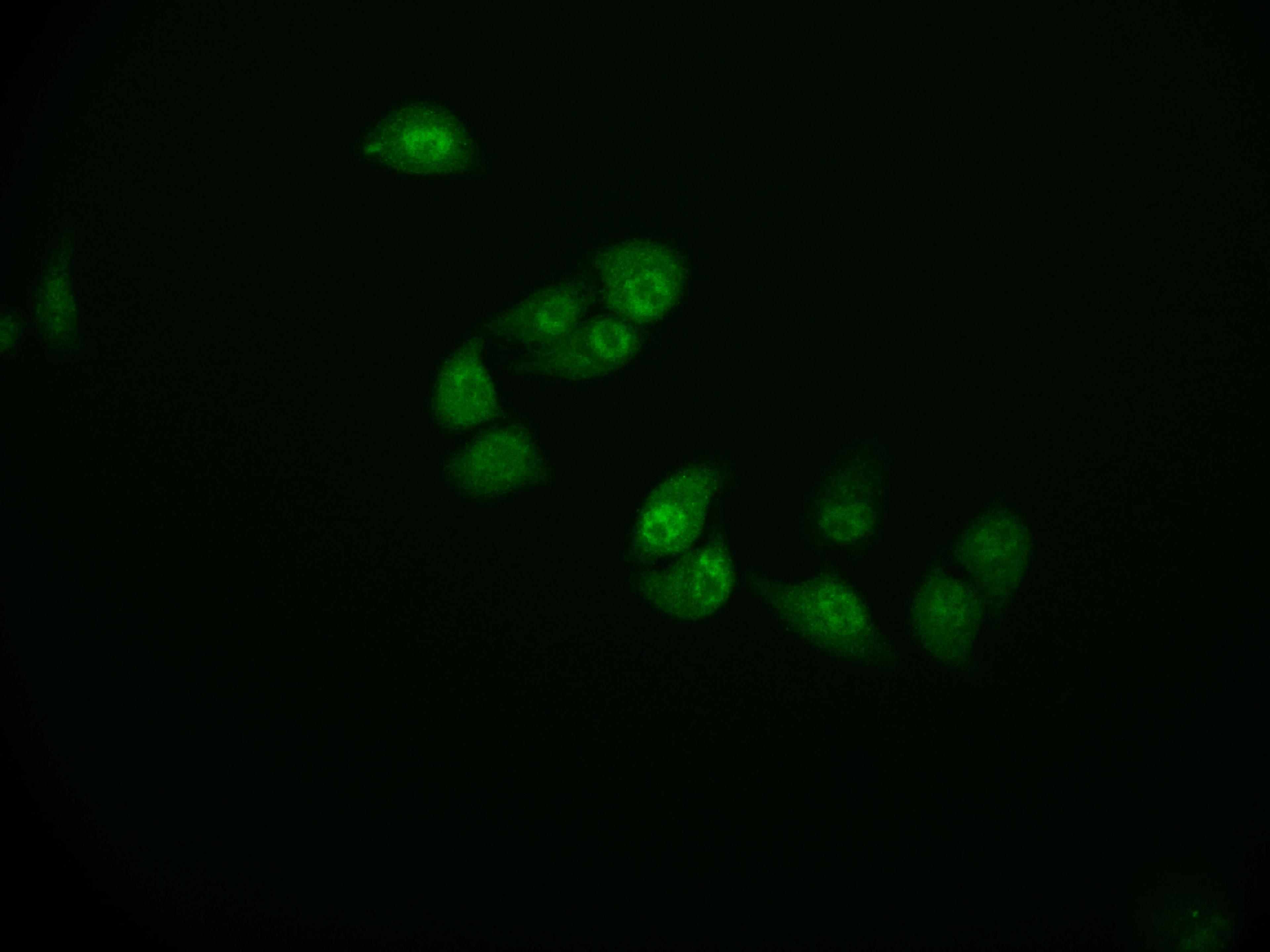 Immunofluorescence staining of Hela cell with CSB-RA914307A0HU at 1:50, counter-stained with DAPI. The cells were fixed in 4% formaldehyde and blocked in 10% normal Goat Serum. The cells were then incubated with the antibody overnight at 4°C. The secondary antibody was Alexa Fluor 591-congugated AffiniPure Goat Anti-Rabbit IgG(H+L).