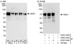 Detection of human and mouse AEG1 by western blot (h & m) and immunoprecipitation (h).