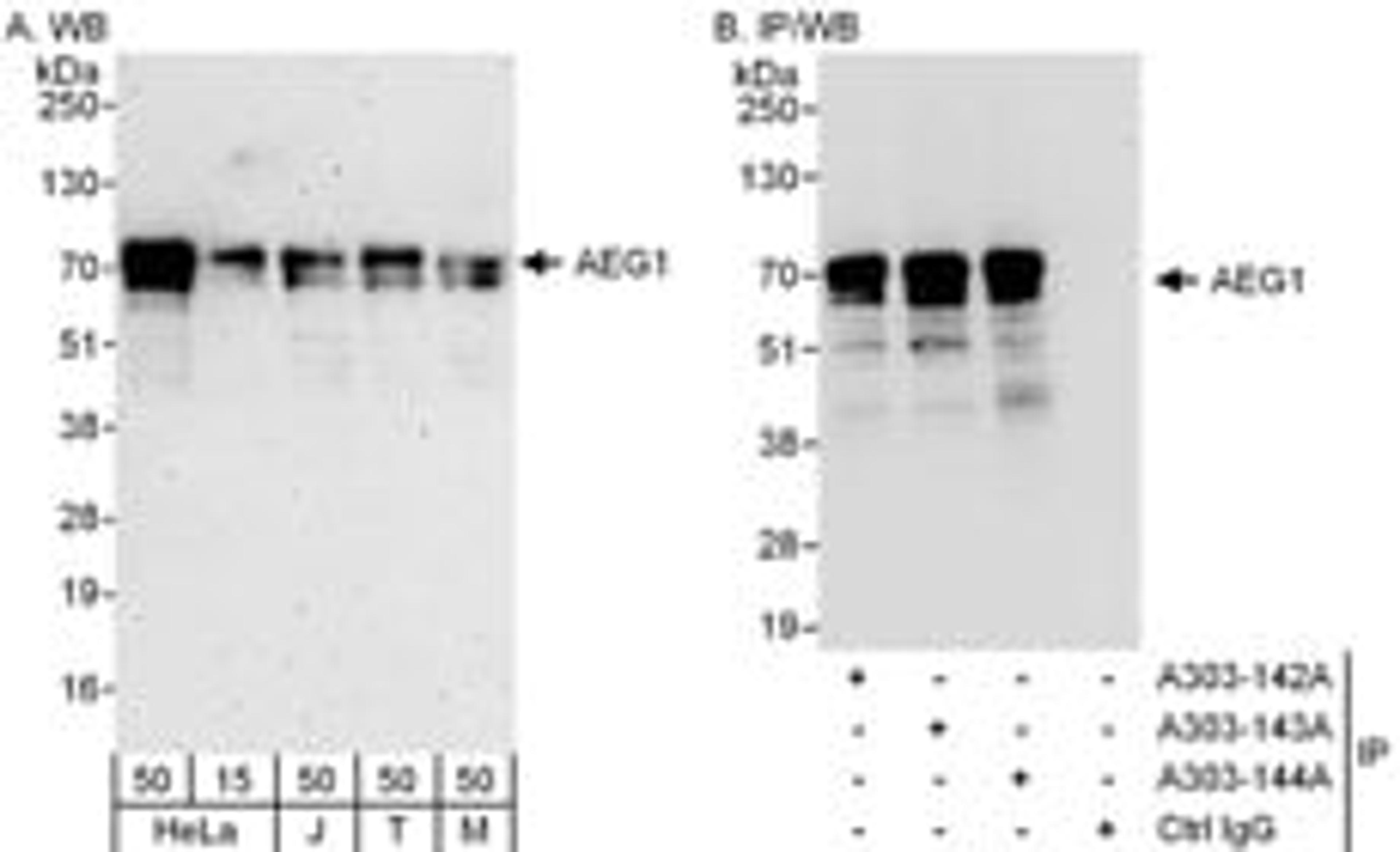 Detection of human and mouse AEG1 by western blot (h & m) and immunoprecipitation (h).