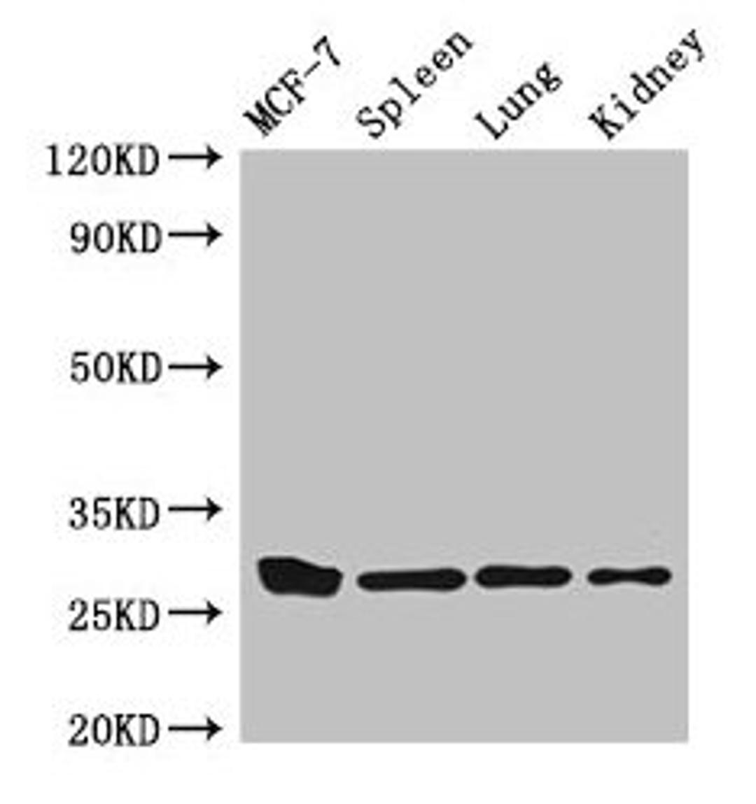 Western Blot. Positive WB detected in: MCF-7 whole cell lysate, Mouse spleen tissue, Mouse lung tissue, Mouse kidney tissue. All lanes: CMA1 antibody at 3µg/ml. Secondary. Goat polyclonal to rabbit IgG at 1/50000 dilution. Predicted band size: 28, 15 kDa. Observed band size: 28 kDa