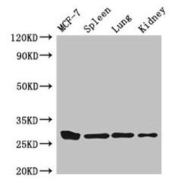 Western Blot. Positive WB detected in: MCF-7 whole cell lysate, Mouse spleen tissue, Mouse lung tissue, Mouse kidney tissue. All lanes: CMA1 antibody at 3µg/ml. Secondary. Goat polyclonal to rabbit IgG at 1/50000 dilution. Predicted band size: 28, 15 kDa. Observed band size: 28 kDa