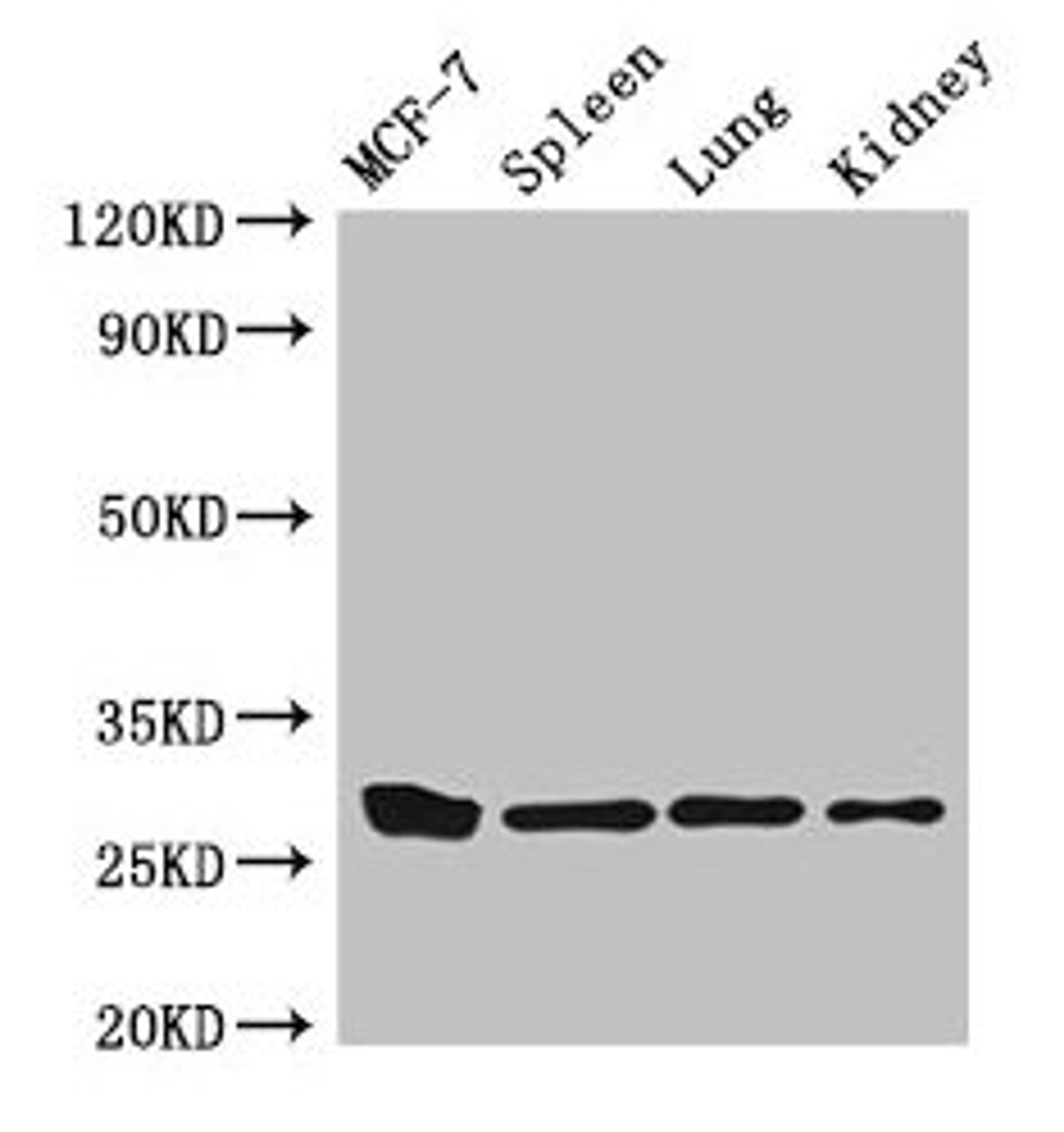 Western Blot. Positive WB detected in: MCF-7 whole cell lysate, Mouse spleen tissue, Mouse lung tissue, Mouse kidney tissue. All lanes: CMA1 antibody at 3µg/ml. Secondary. Goat polyclonal to rabbit IgG at 1/50000 dilution. Predicted band size: 28, 15 kDa. Observed band size: 28 kDa