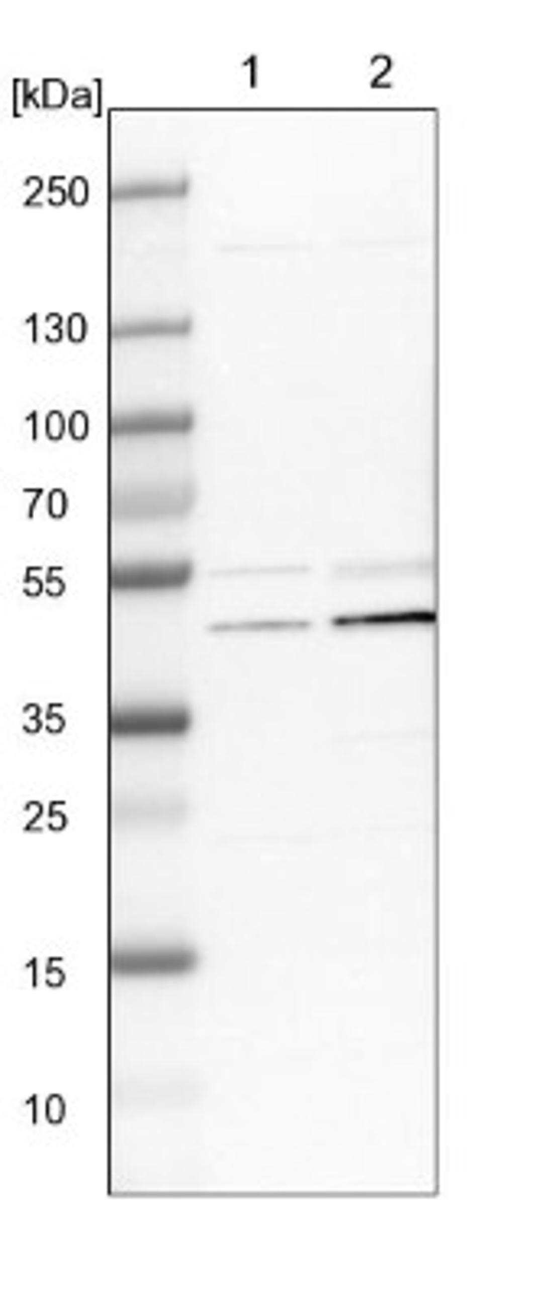 Western Blot: UQCRC2 Antibody [NBP1-80861] - Lane 1: NIH-3T3 cell lysate (Mouse embryonic fibroblast cells)<br/>Lane 2: NBT-II cell lysate (Rat Wistar bladder tumour cells)