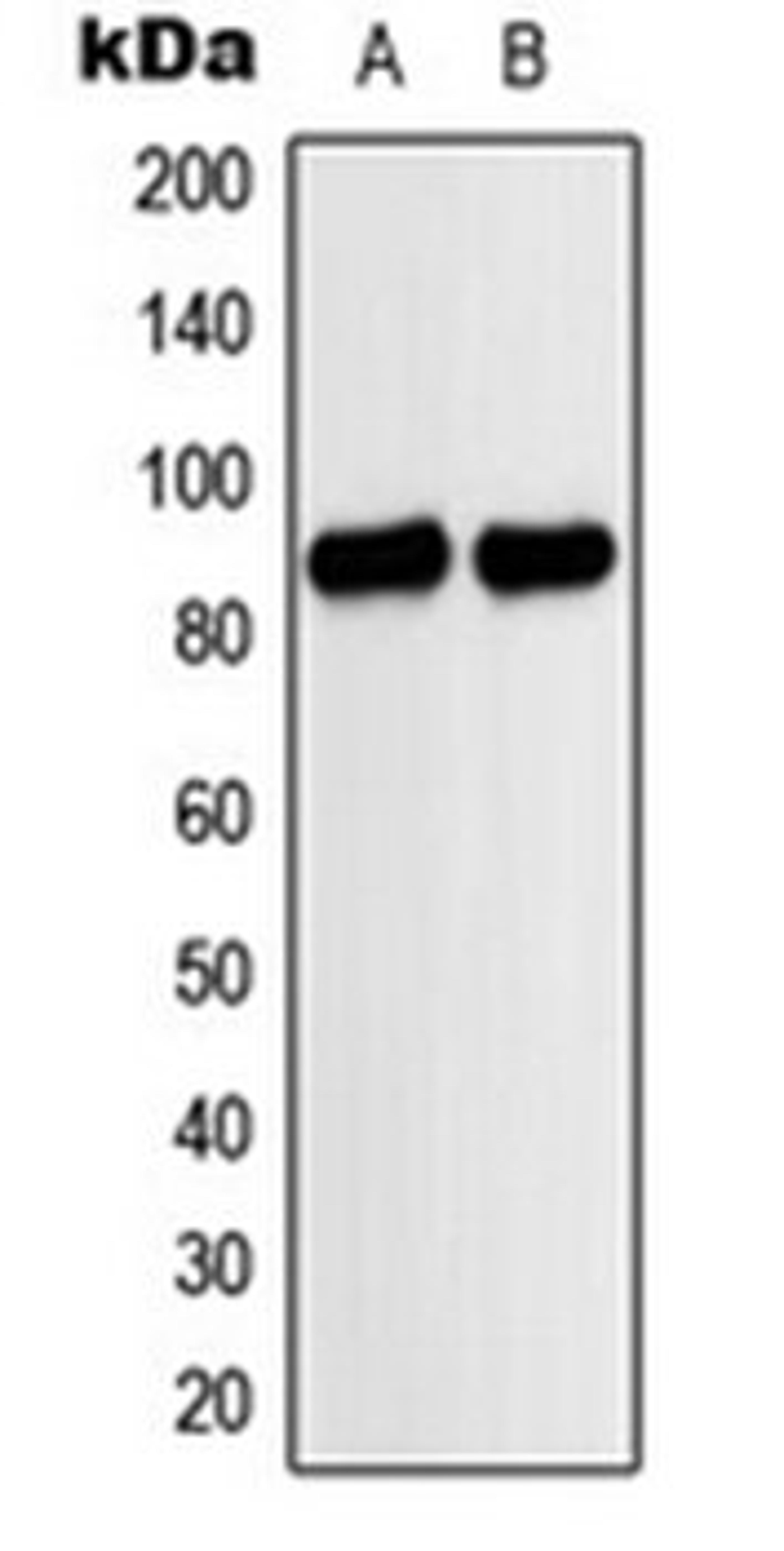 Western blot analysis of A549 (Lane 1), HeLa (Lane 2) whole cell lysates using MARK antibody