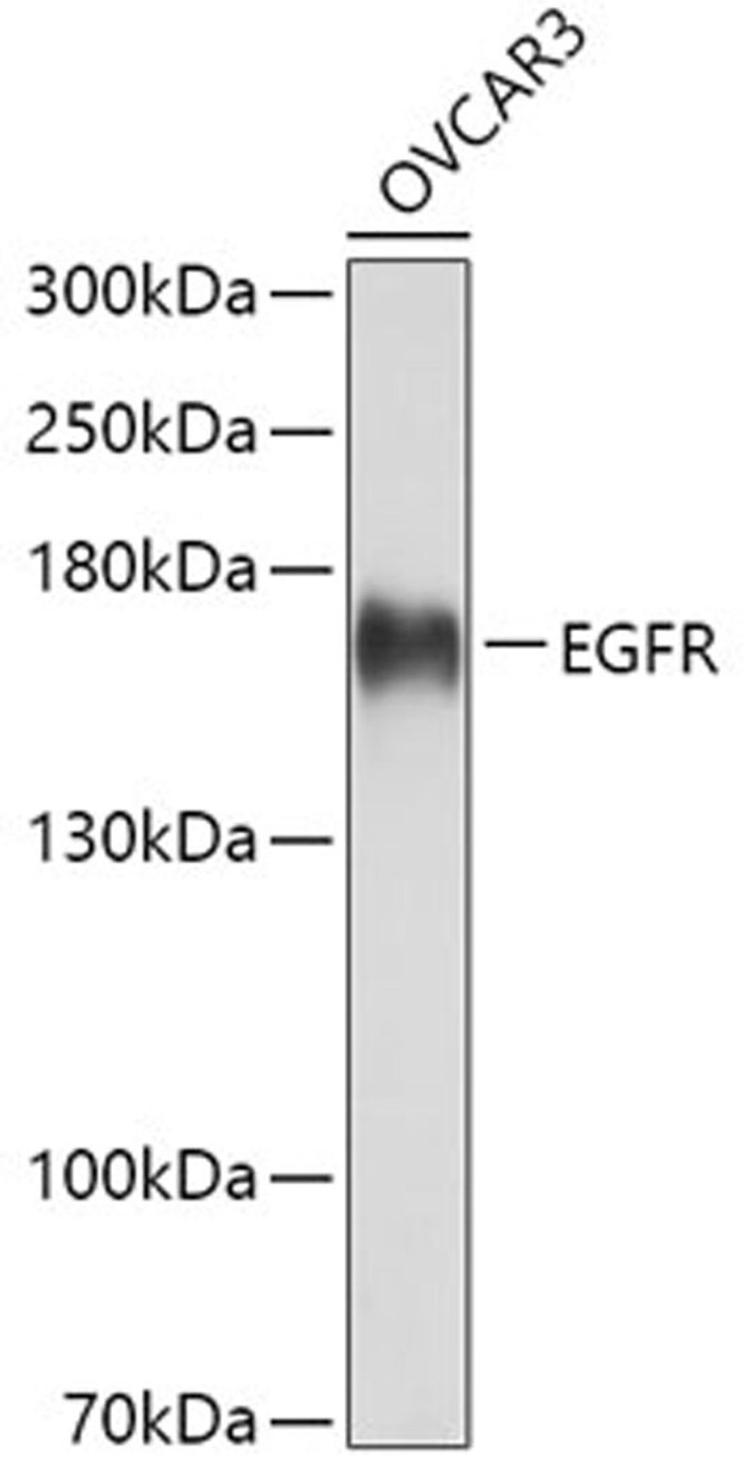 Western blot - EGFR antibody (A11577)