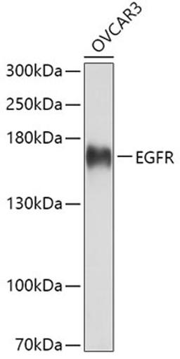 Western blot - EGFR antibody (A11577)