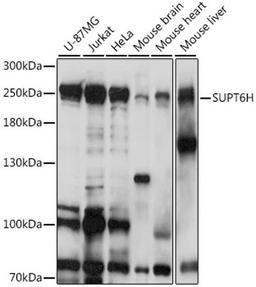 Western blot - SUPT6H antibody (A16434)