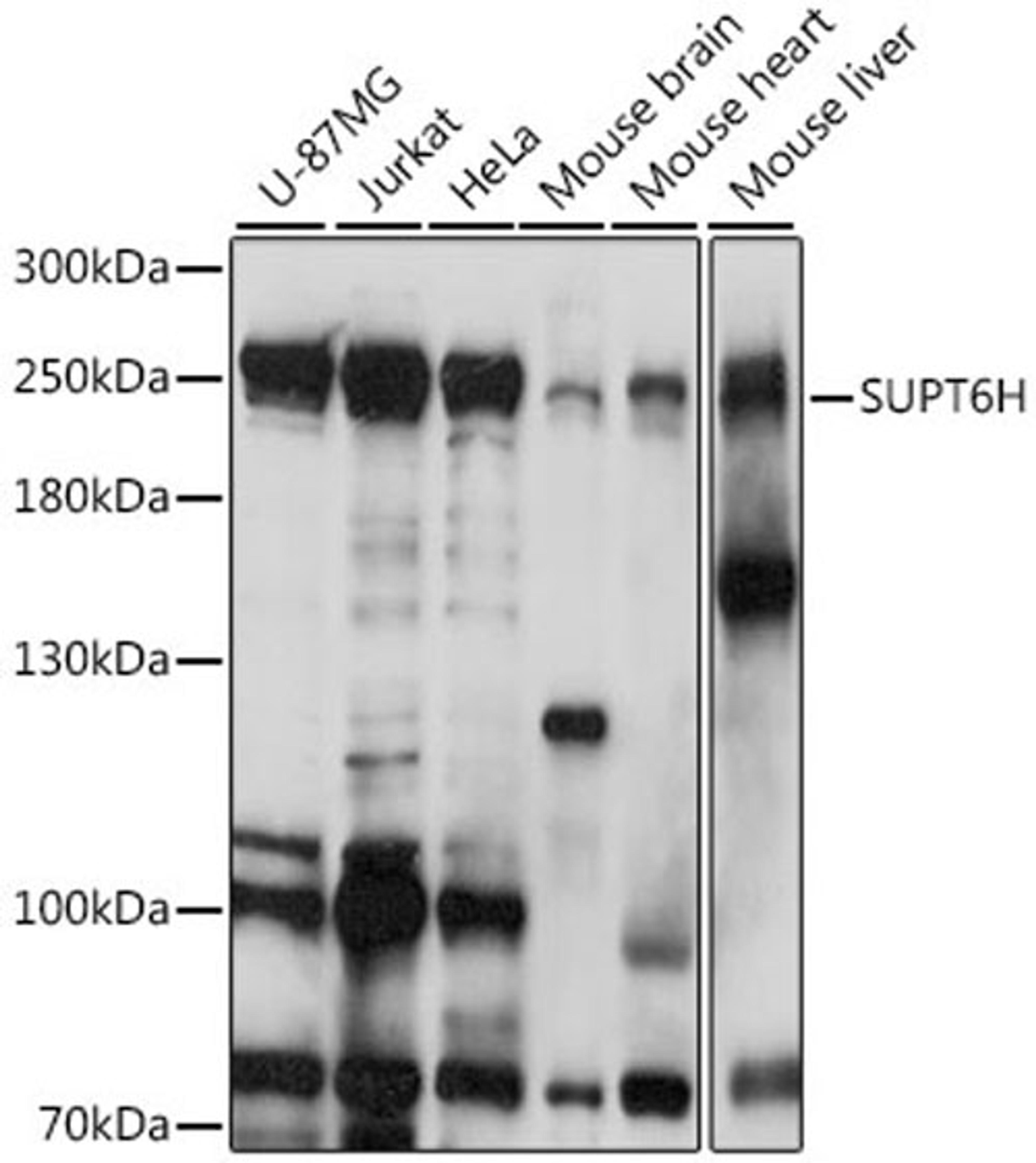 Western blot - SUPT6H antibody (A16434)