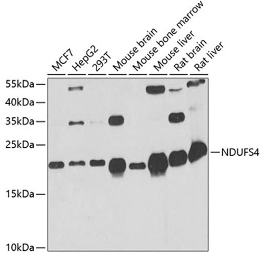 Western blot - NDUFS4 antibody (A13519)