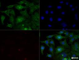 Immunocytochemistry/Immunofluorescence: Integrin beta 1/CD29 Antibody (P4C10) [NBP2-36561] - Integrin beta 1 (P4C10) antibody was tested in -20 degree MeOH fixed HeLa cells at a 1:200 dilution against Dylight 488 (Green). Actin and nuclei were counterstained against Phalloidin 568 (Red) and DAPI (Blue), respectively.