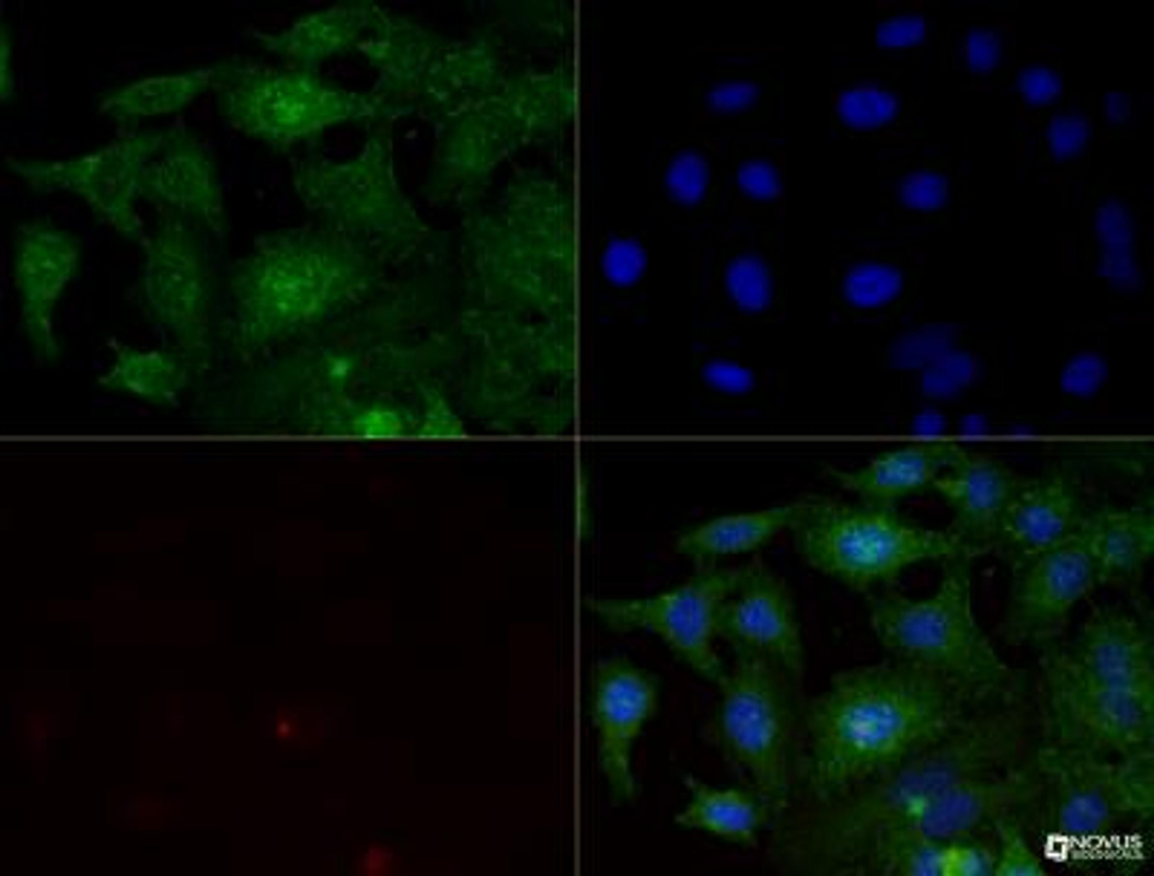 Immunocytochemistry/Immunofluorescence: Integrin beta 1/CD29 Antibody (P4C10) [NBP2-36561] - Integrin beta 1 (P4C10) antibody was tested in -20 degree MeOH fixed HeLa cells at a 1:200 dilution against Dylight 488 (Green). Actin and nuclei were counterstained against Phalloidin 568 (Red) and DAPI (Blue), respectively.