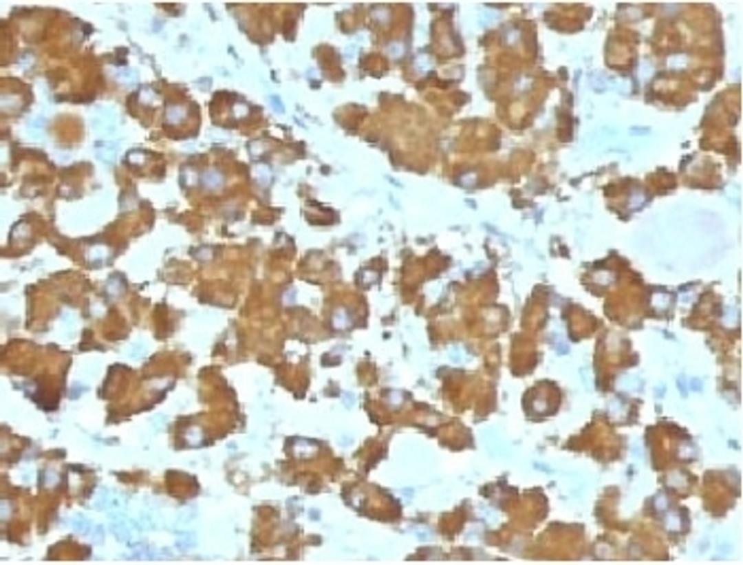 IHC testing of FFPE human pituitary gland with Growth Hormone antibody (clone GRHP1-1). Required HIER: boil tissue sections in 10mM citrate buffer, pH 6, for 10-20 min.