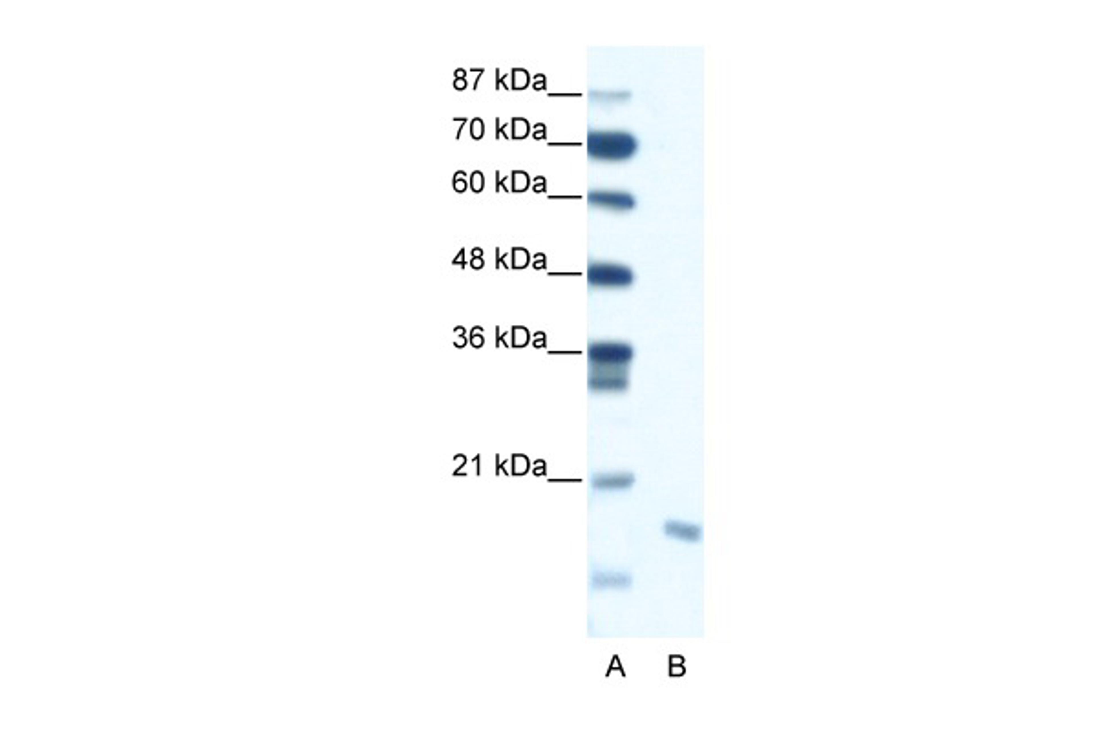 Antibody used in WB on Human Jurkat 0.3125 ug/ml.