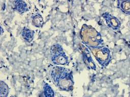 Immunohistochemical staining of rat skin tissue using Cryopyrin antibody (dilution of primary antibody - 1:200)