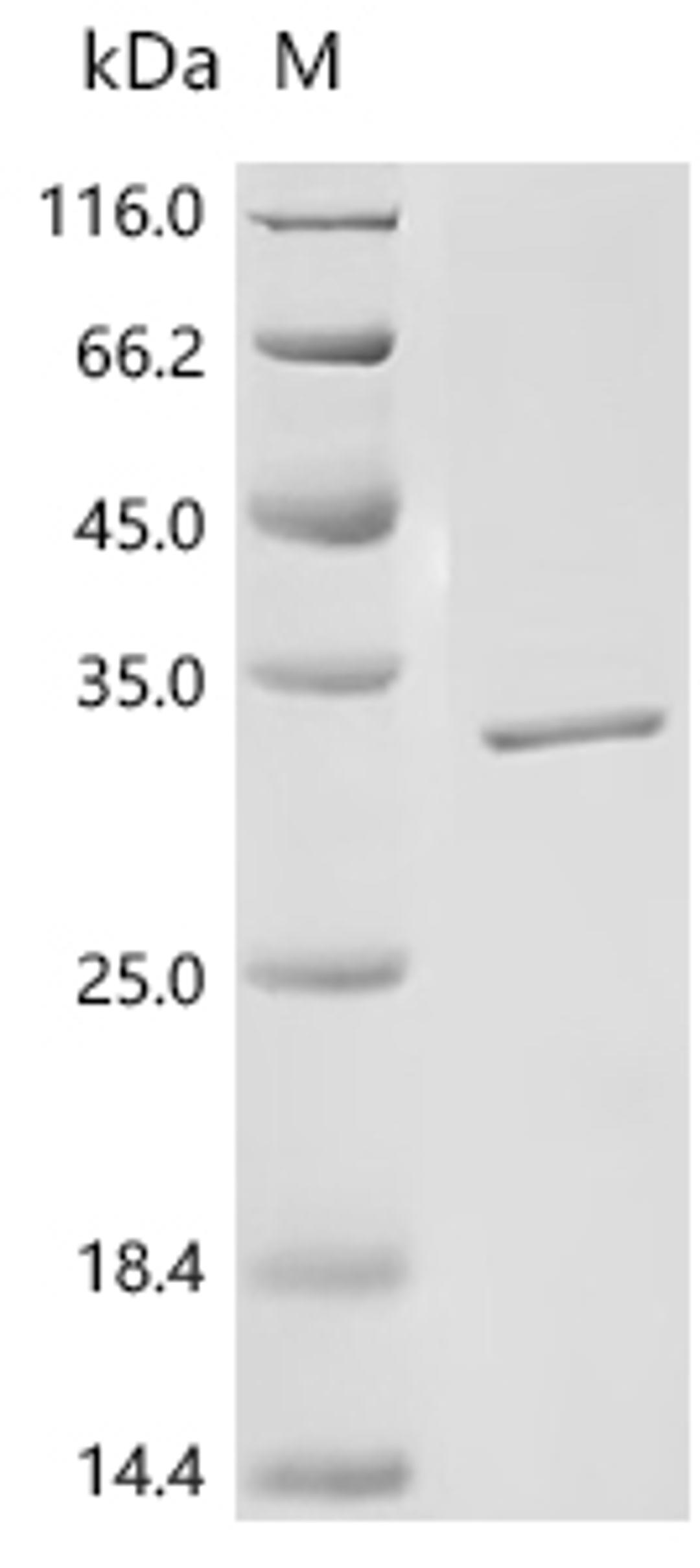 (Tris-Glycine gel) Discontinuous SDS-PAGE (reduced) with 5% enrichment gel and 15% separation gel.