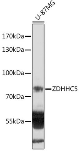 Western blot - ZDHHC5 antibody (A18114)