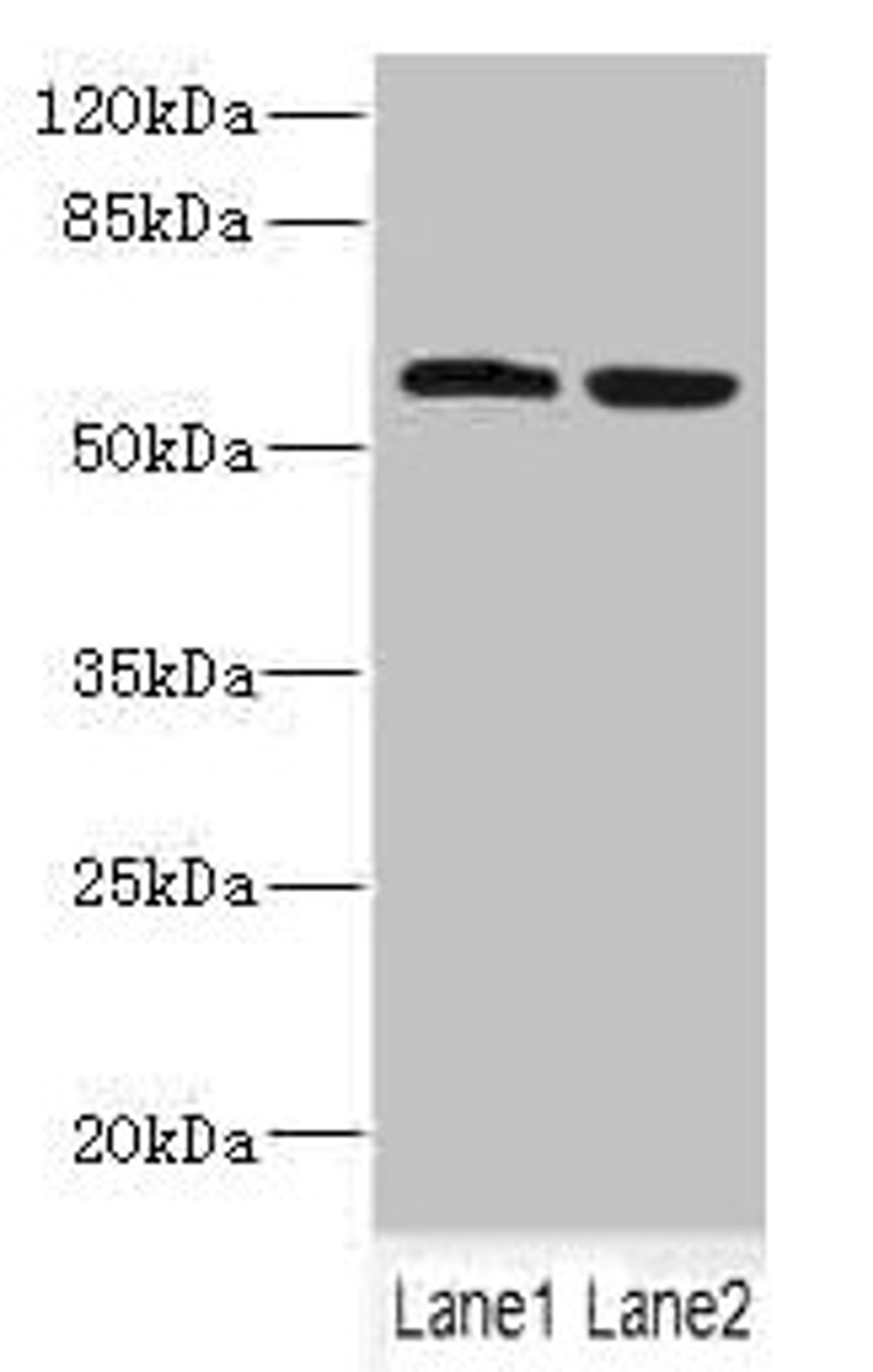 Western blot. All lanes: FTCD antibody at 5.46ug/ml. Lane 1: HepG2 whole cell lysate. Lane 2: 293T whole cell lysate. Secondary. Goat polyclonal to rabbit IgG at 1/10000 dilution. Predicted band size: 59, 62, 53, 17 kDa. Observed band size: 59 kDa.
