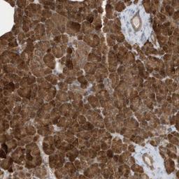 Immunohistochemistry-Paraffin: CLCN4 Antibody [NBP1-84452] - Staining of human pancreas shows strong cytoplasmic positivity in exocrine cells.