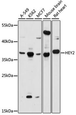 Western blot - HEY2 antibody (A15143)