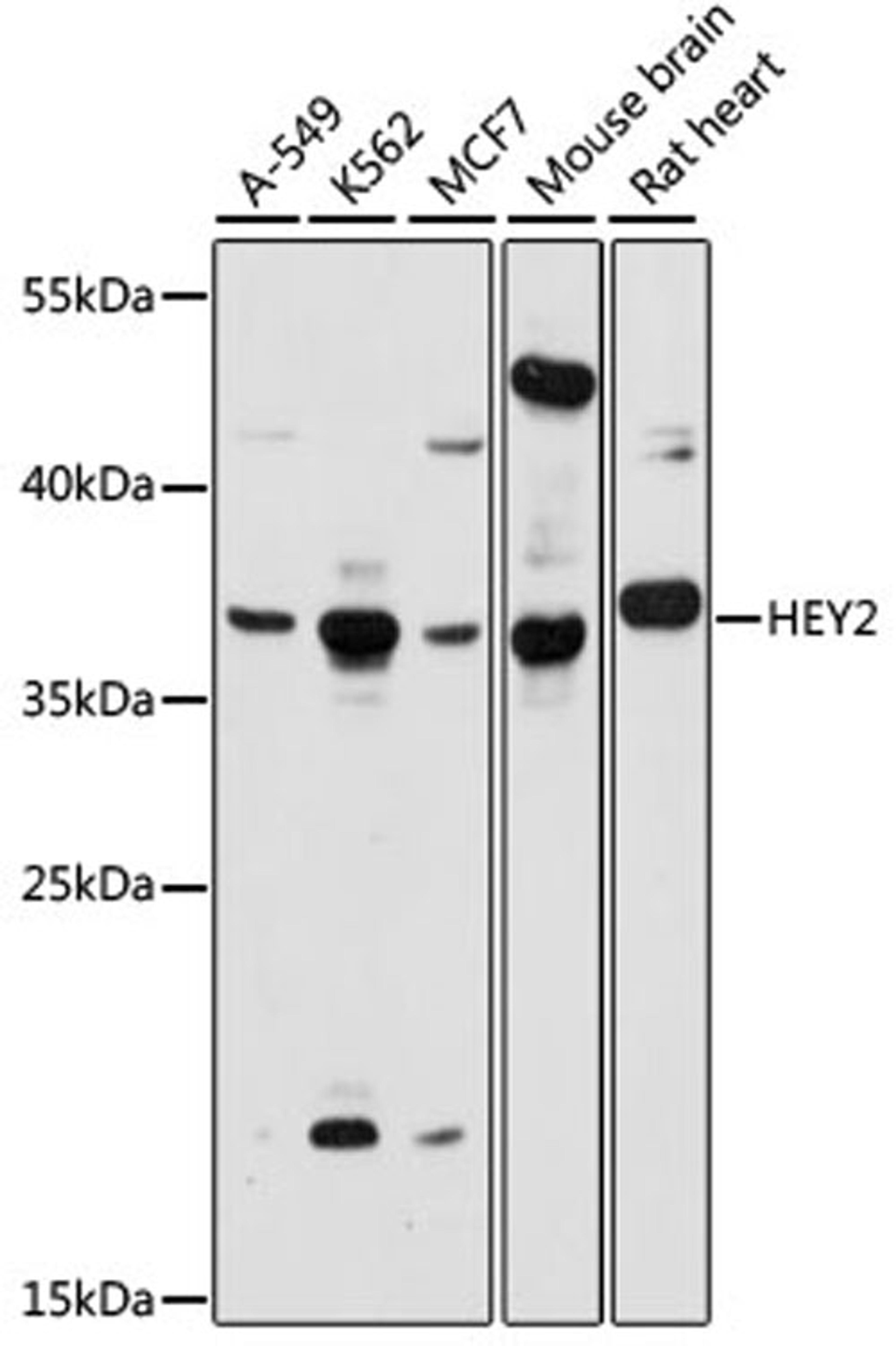 Western blot - HEY2 antibody (A15143)