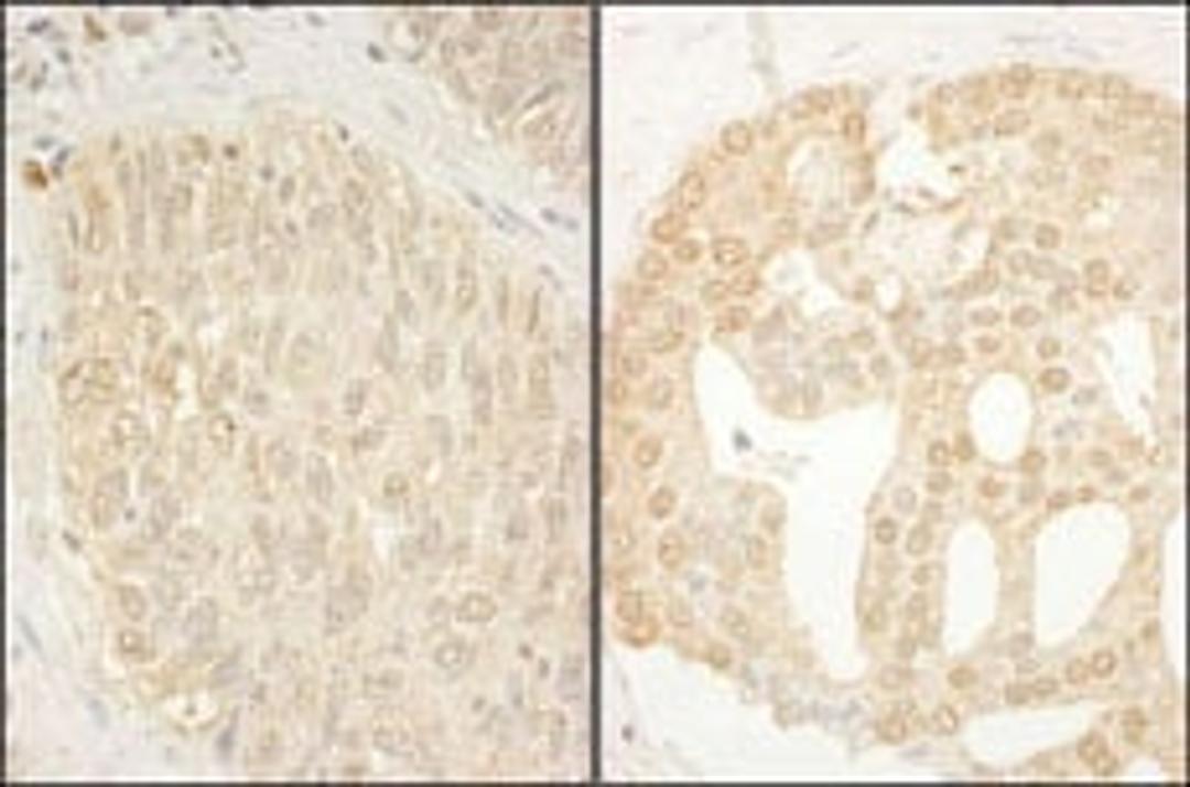 Detection of human CaMKK alpha by immunohistochemistry.