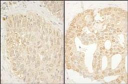 Detection of human CaMKK alpha by immunohistochemistry.