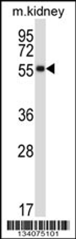 Western blot analysis in mouse kidney tissue lysates (35ug/lane).