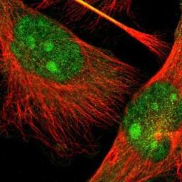 Immunocytochemistry/Immunofluorescence: TAO2 Antibody [NBP1-81465] - Staining of human cell line U-251MG shows positivity in nucleus, nucleoli & cytoplasm.