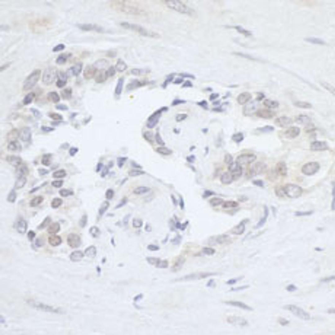 Detection of human RPC2 by immunohistochemistry.