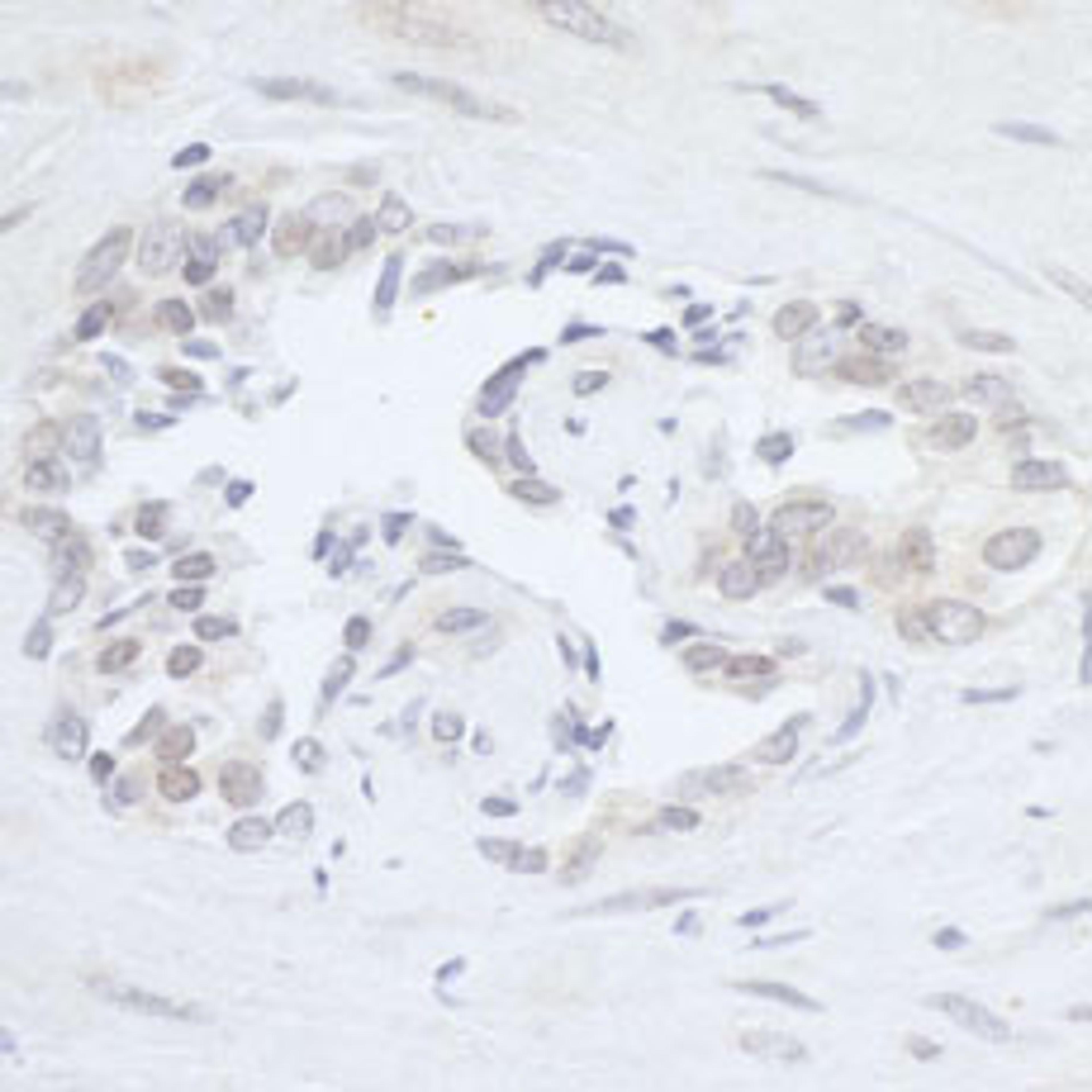 Detection of human RPC2 by immunohistochemistry.