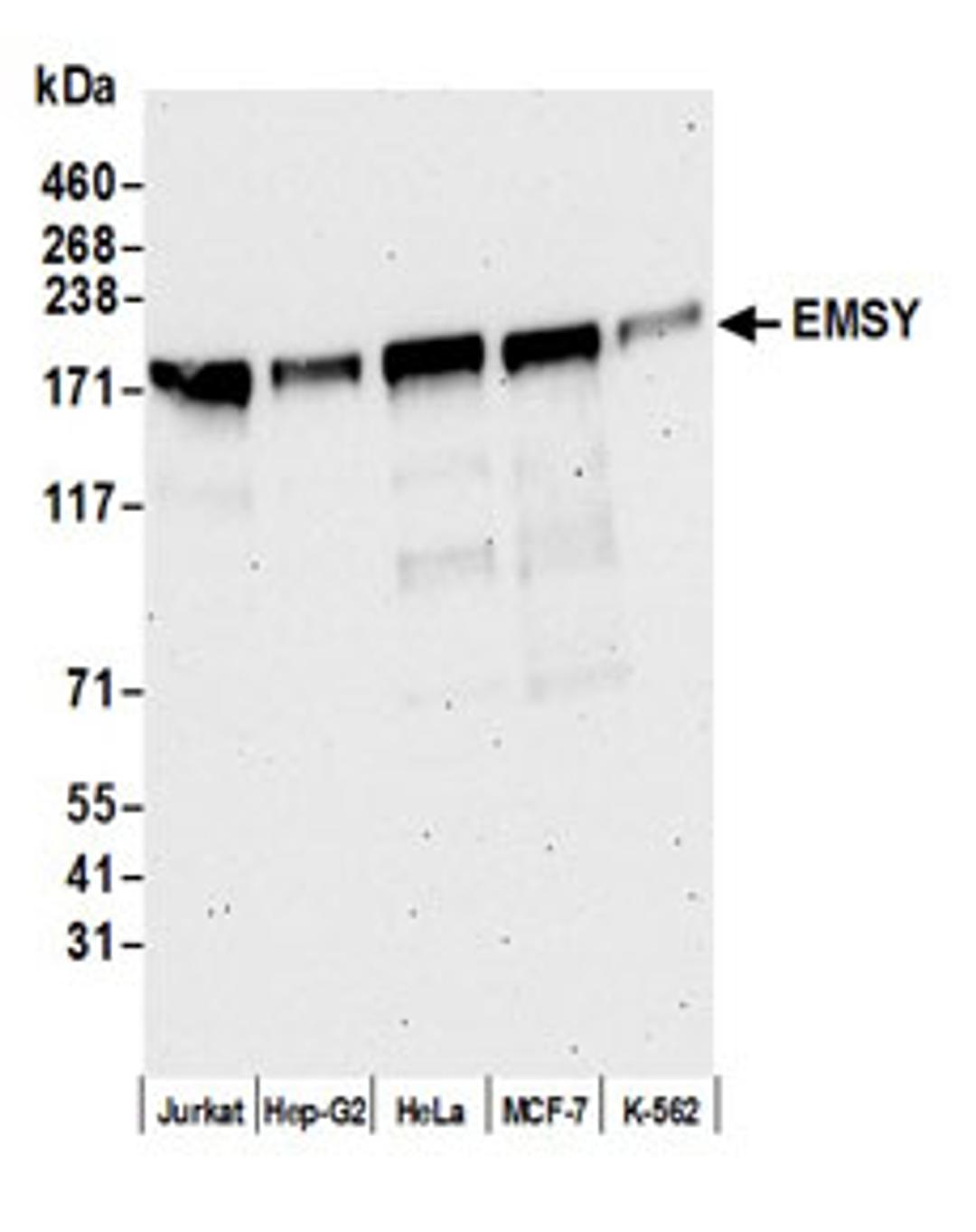 Detection of human EMSY by western blot.