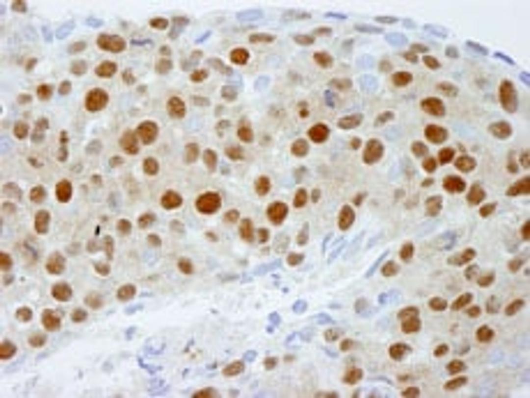 Detection of human DDB1 by immunohistochemistry.