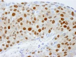 Detection of human DDB1 by immunohistochemistry.